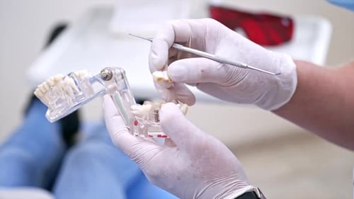 Doctor holding teeth model. Dentist holding educational model of oral cavity in clinic