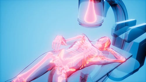 X-ray Examination Medical Scan Footage