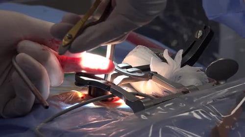 Chirurgie de la colonne vertébrale