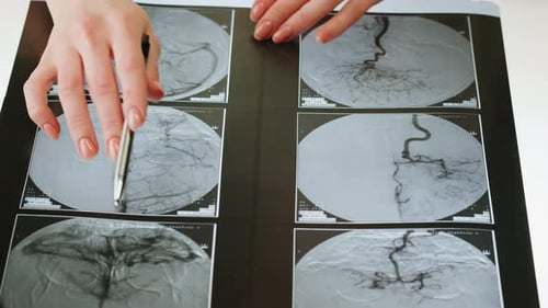 Magnetic Resonance Image of Head Xray
