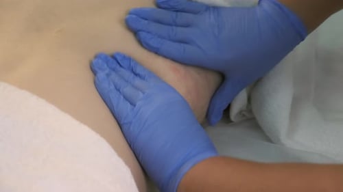 Un médecin masse le corps d'une femme après l'injection de gaz ozone dans l'abdomen