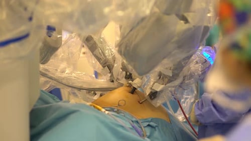 Robotic Surgery in Hospital Operating Room