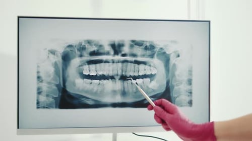 The Dentist Examines a Panoramic Xray of the Teeth