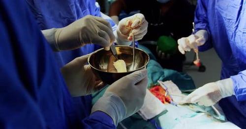 Surgeons performing operation 4k