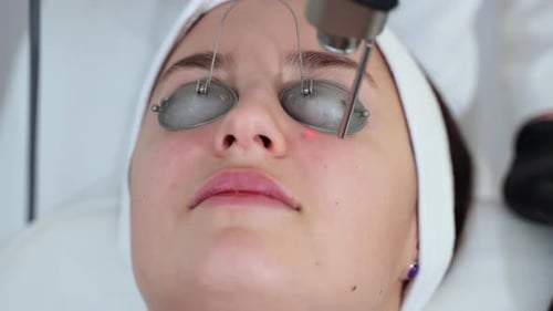 Laser Surgery for Cosmetology Clinic Skincare and Antiage Treatment with Using Laser Apparatus