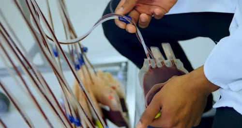 Laboratory technician analyzing blood bag 4k