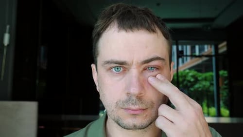 Adult Man with Eye Irritation Close Up