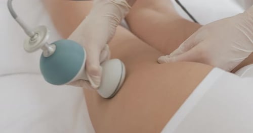 Cosmetic Procedure on Thigh with Medical Device