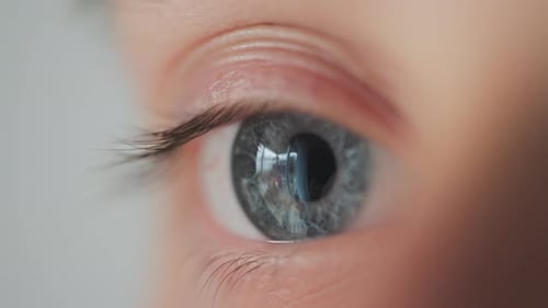 Adolescent Blue Eye
