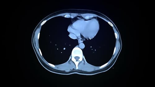 Medical CT Scan Scrolling Through Human Torso and Pelvis