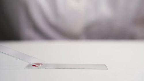 Un gros plan est une procédure d'analyse sanguine en laboratoire. Un technicien de laboratoire fait un frottis sanguin pour