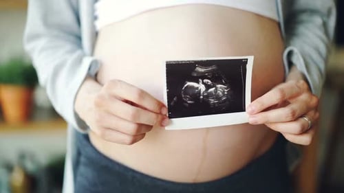 Primer plano del vientre de la mujer embarazada y las manos femeninas sosteniendo la imagen de ultrasonido de un feto sano
