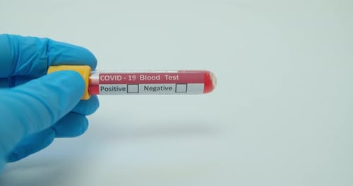 Marking Negative Covid-19 Blood Test Results