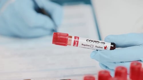 Medical Professional Records Positive COVID-19 Blood Test