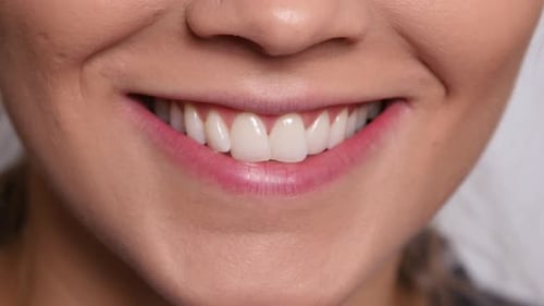 Woman's Beautiful White Smile Close-Up
