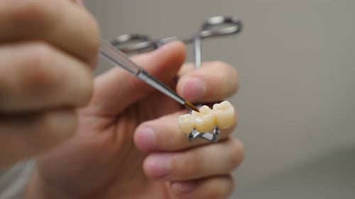 Crafting a Dental Bridge Prosthesis in a Lab