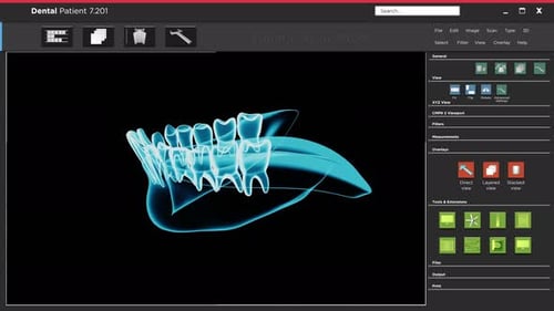 Rotating 3D Dental Scan of Human Jaw and Teeth Animation