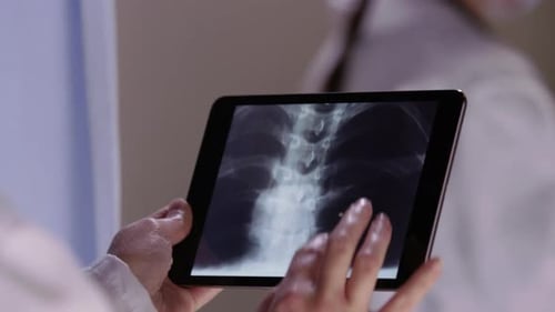 Doctor looks at x-rays with touch screen tablet