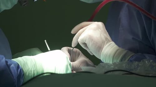 Surgeons Perform Intricate Operation in Operating Room
