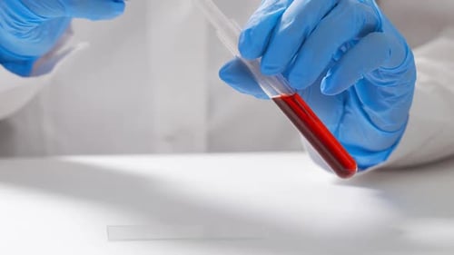 Pipetting Blood Sample for Scientific Research