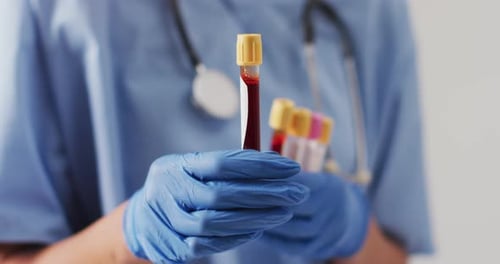 Medical Professional Holding Vials of Blood Close Up