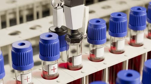 Un robot de laboratoire moderne analyse des échantillons de sang. Automatisé. Positif Bouclable. 4 kHD