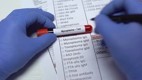 Mycoplasma, Doctor Checking Disease in Lab Blank, Showing Blood Sample in Tube