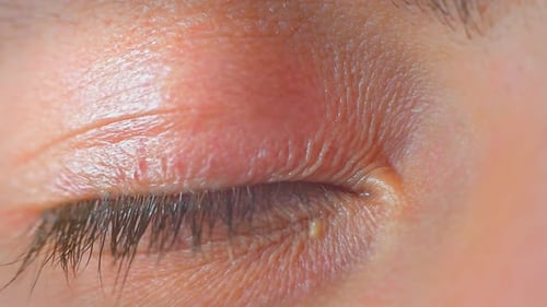 Extreme Close Up of an Eye Blinking