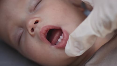 Les médecins vérifient les mains du bébé endormi, premier lait, dentition, dentition des gencives
