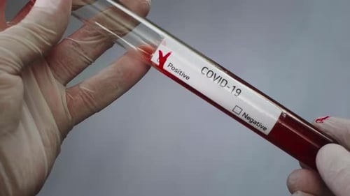COVID-19 Test Tube Showing Positive Result