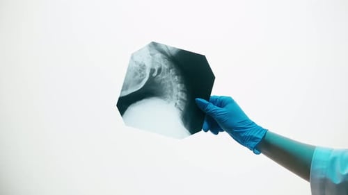 Hand Holds Up an X-Ray Image
