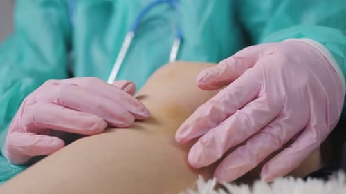 Nahaufnahme der Hände des Arztes in medizinischen Handschuhen, der das verletzte Knie einer Patientin untersucht