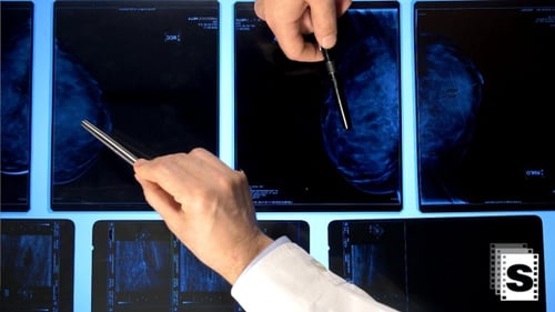 Medical Professional Analyzing Mammogram Images with Pen