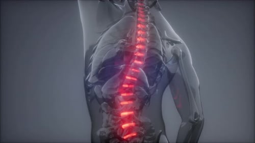 Backache in Back Bones