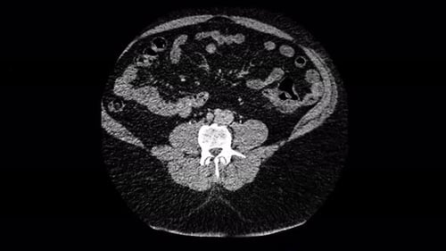 Visualización de rayos X Diagnóstico médico Exploraciones de IRM para análisis clínicos
