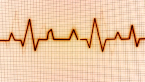 New Color Heartbeat Signal Animation
