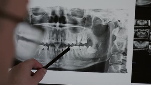 Doctor Examines Xray Light Screen