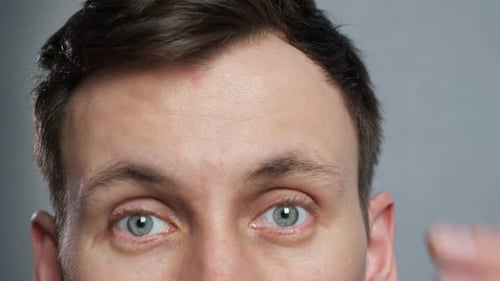 Young Adult Checking Hairline and Forehead Close Up