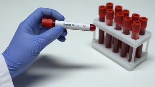 Blood Sample in Tube Testing Positive