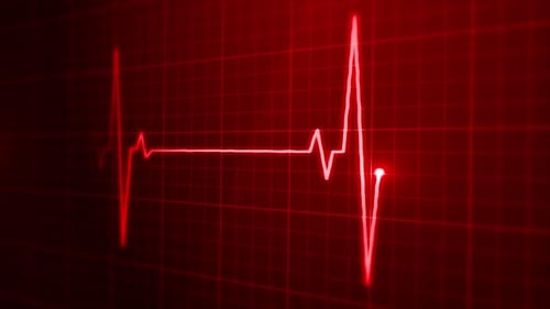EKG-Puls