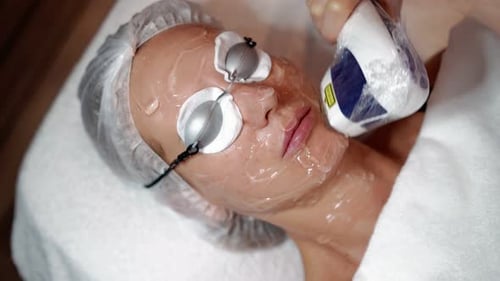 Woman Receiving Laser Skin Treatment on Face