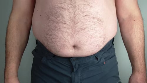 An overweight man cannot hold in his stomach anymore. Bulging belly.