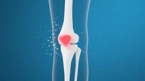 Animated Human Knee Joint Pain Relief Medical Concept