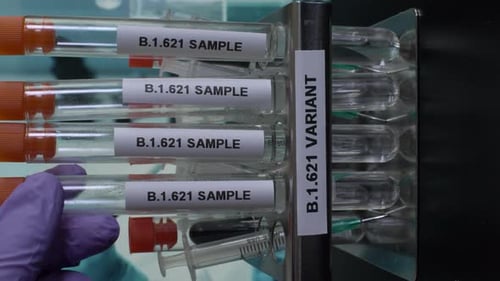 B.1.621 Proben des Reagenzglases werden aus dem Gestell entnommen. Vertikales Video, gesperrt, Aufnahme einrichten