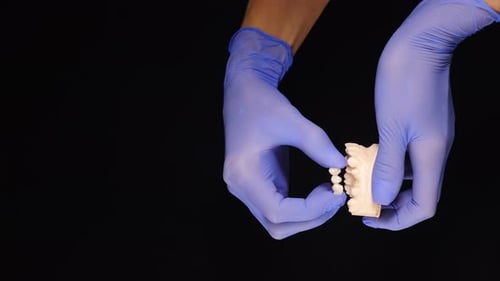 Gloved Hands Placing Dental Restoration on Dental Mold