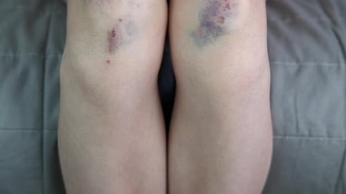 Violence familiale et infantile