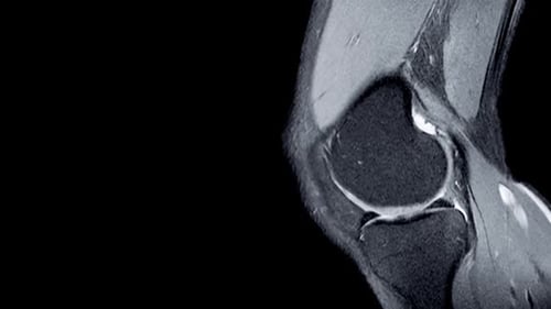 Monochromatic Medical Scan Showing Knee Joint