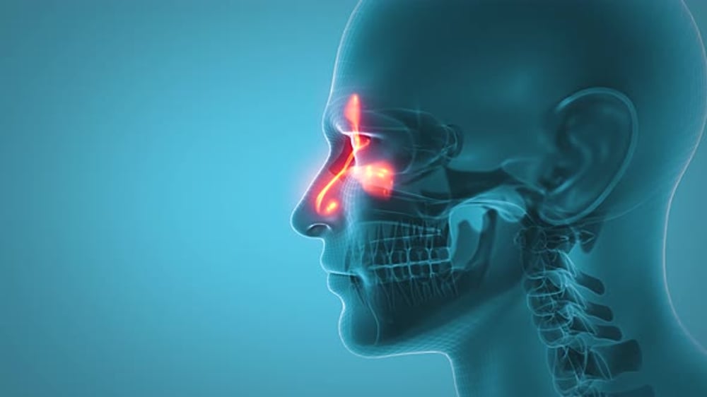 Medical Human Head Wireframe with Glowing Sinuses Animation ...