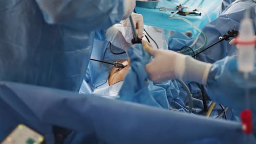 The Surgeon's Doing Laparoscopic Surgery in the Operating Room