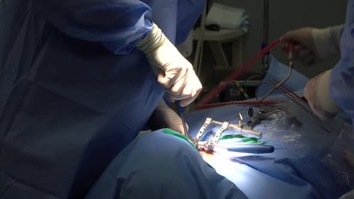 Surgeons Performing Detailed Medical Procedure in Operating Room
